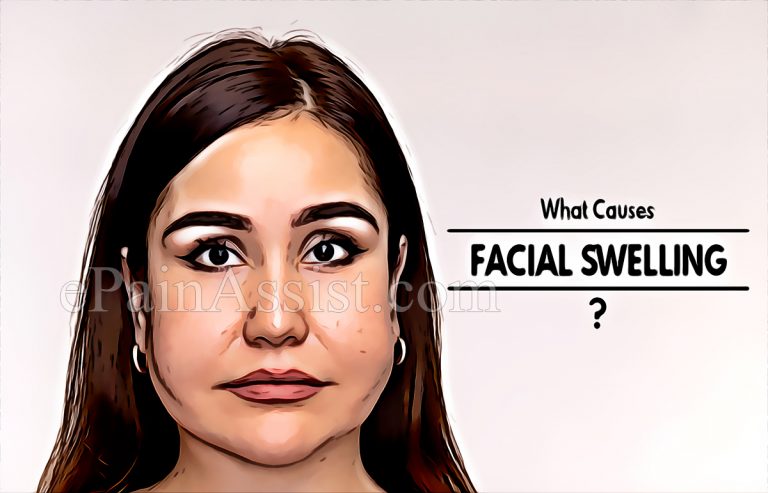 What Causes Facial Swelling?