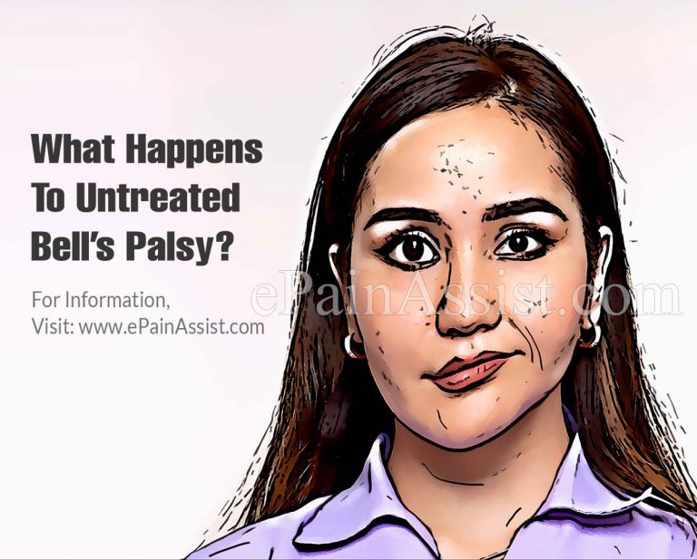 What Happens To Untreated Bell’s Palsy & When To Go To Doctor For It?