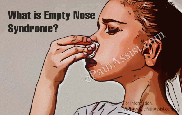 Empty Nose Syndrome: Causes, Symptoms, Treatment