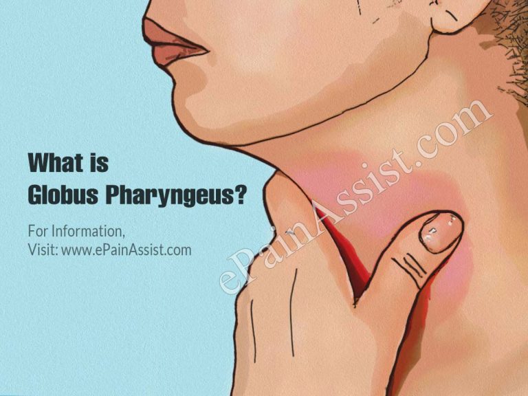 What Is Globus Pharyngeus & How To Deal With It?