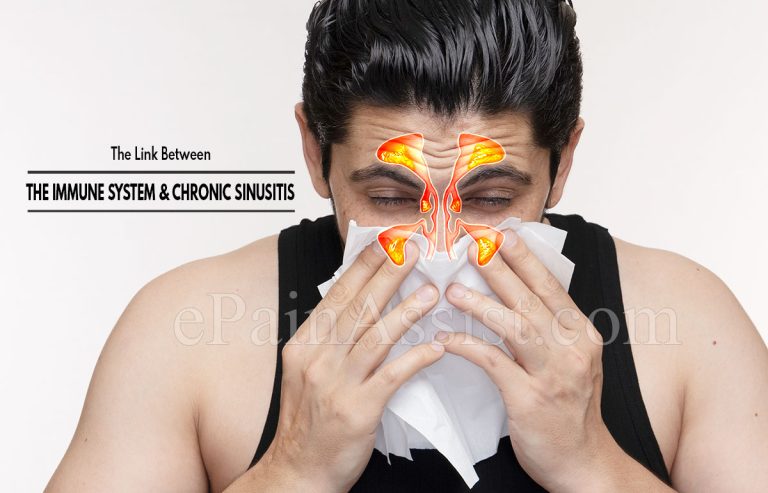 The Immune System and Chronic Sinusitis : Understanding the Connection