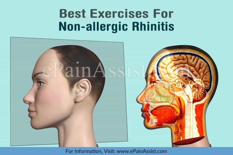 Best Exercises/Activities For Non-Allergic Rhinitis