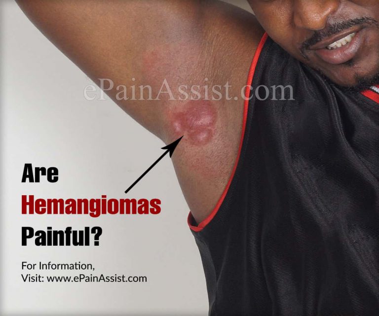 Are Hemangiomas Painful?