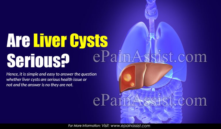 Are Liver Cysts Serious?