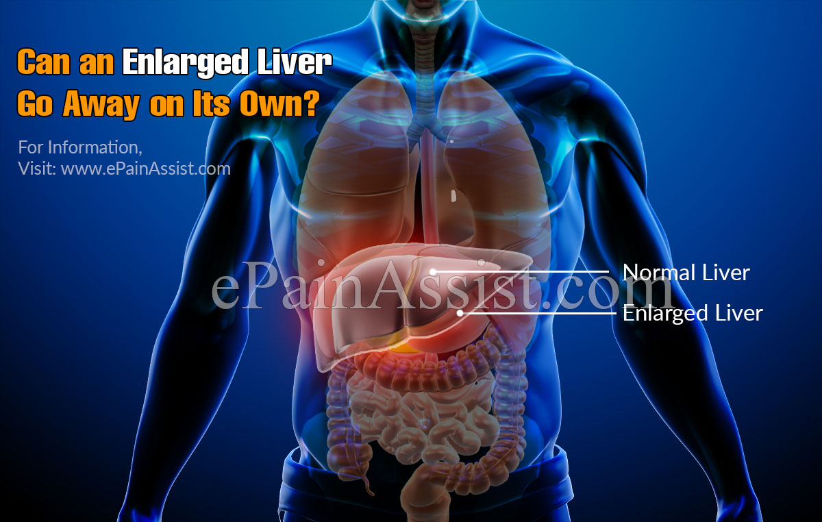 Can An Enlarged Liver Go Away On Its Own?