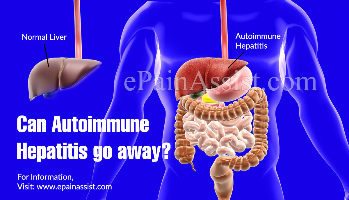 Can Autoimmune Hepatitis go away?