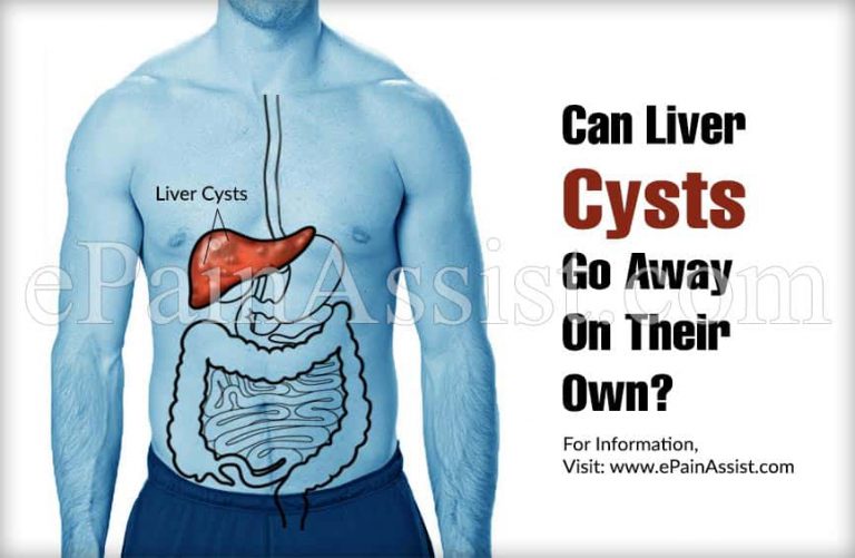 Can Liver Cysts Go Away On Their Own?