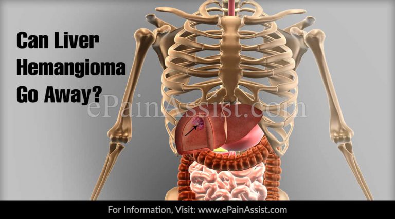 Can Liver Hemangioma Go Away?