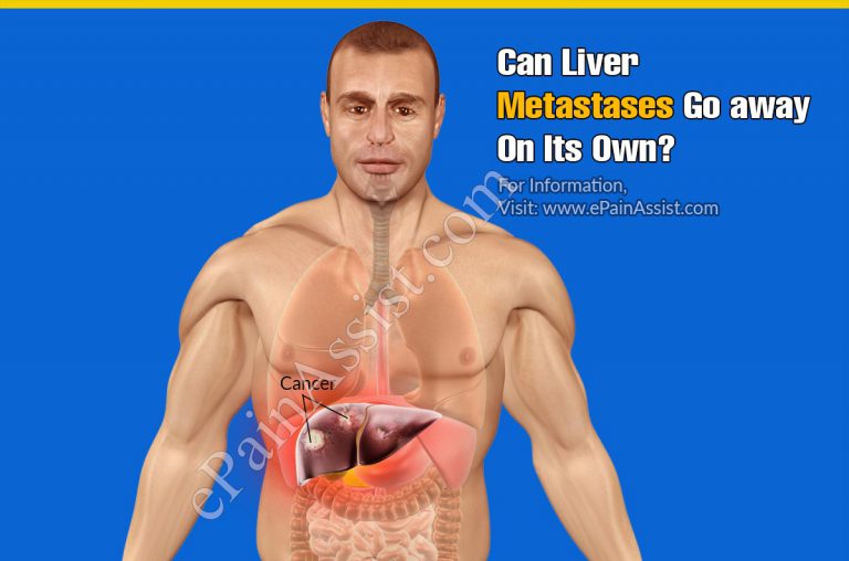 Can Liver Metastases Go Away On Its Own?