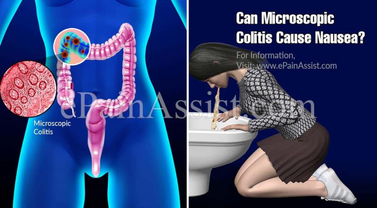 Can Microscopic Colitis Cause Nausea?