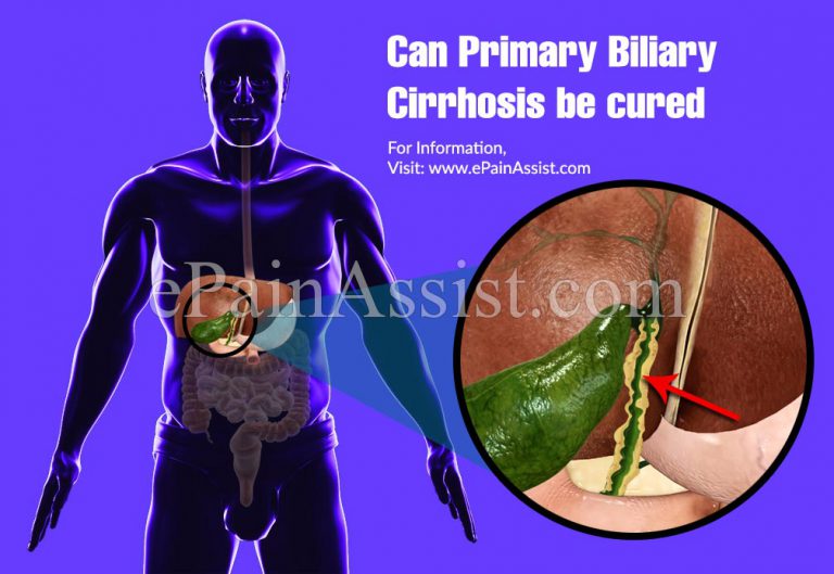 Can Primary Biliary Cirrhosis be Cured?