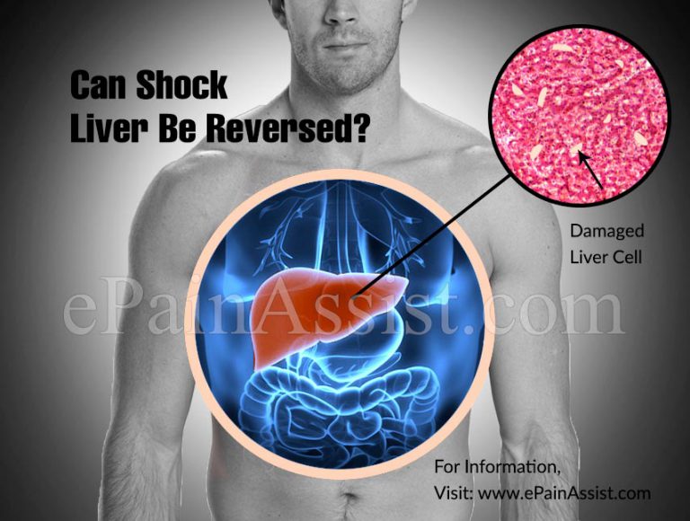 Can Shock Liver Be Reversed?