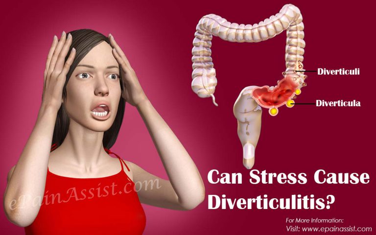 Can Stress Cause Diverticulitis?