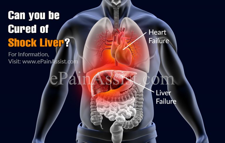 Can You Be Cured Of Shock Liver?