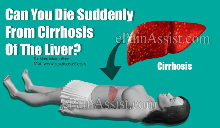 Can You Die Suddenly From Cirrhosis Of The Liver?