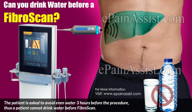 Can you drink Water before a FibroScan?