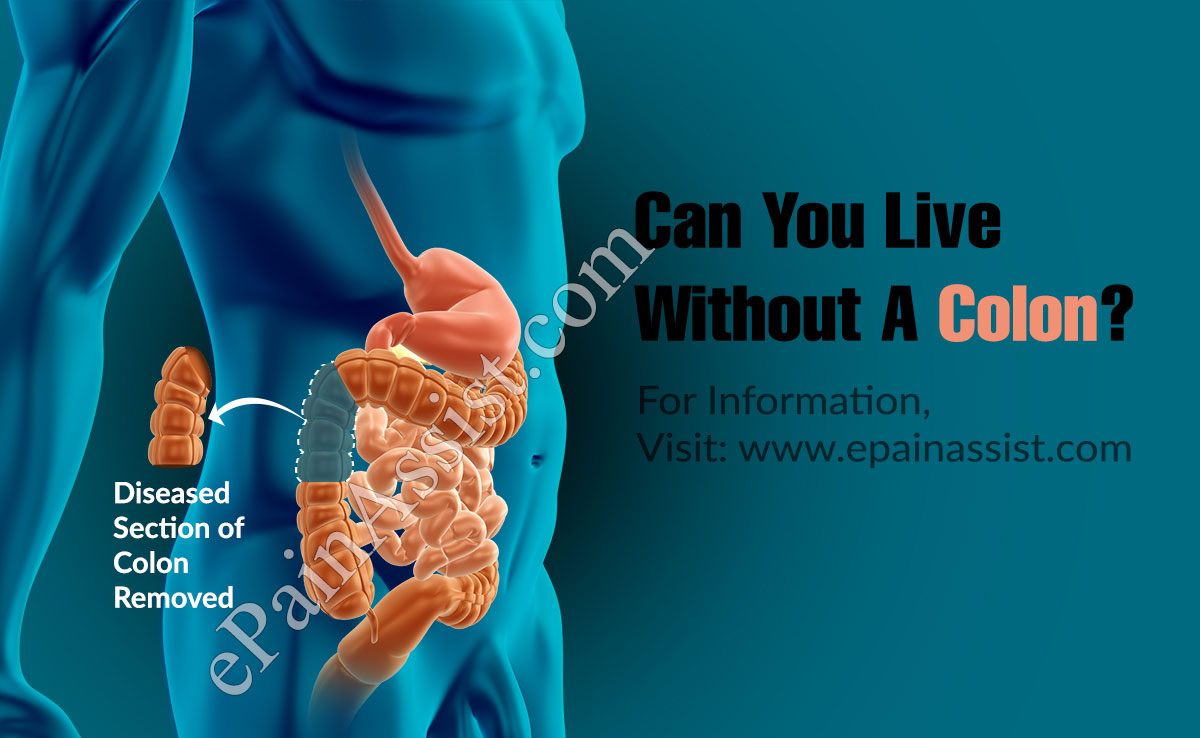 Can You Live Without A Colon?