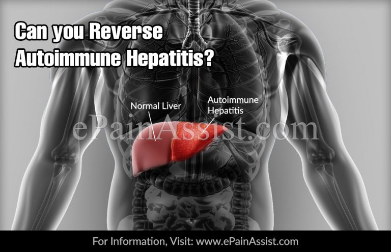 Can You Reverse Autoimmune Hepatitis?