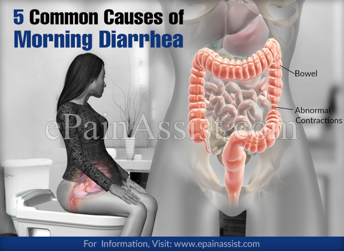 5 Common Causes of Morning Diarrhea