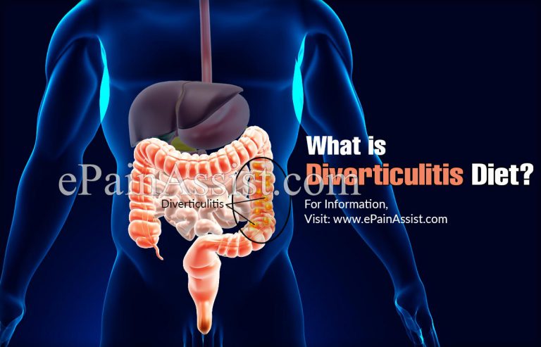 Diverticulitis Diet: Foods to Eat & Foods to Avoid|Risks Associated with Diverticulitis Diet