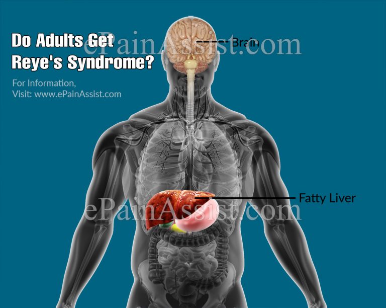 Do Adults Get Reye’s Syndrome?