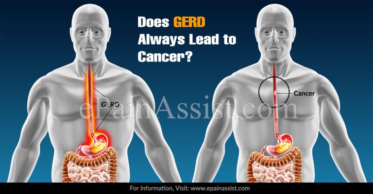 Does GERD Always Lead to Cancer?