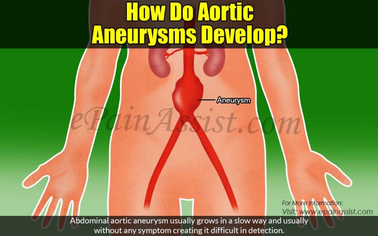 How Do Aortic Aneurysms Develop?