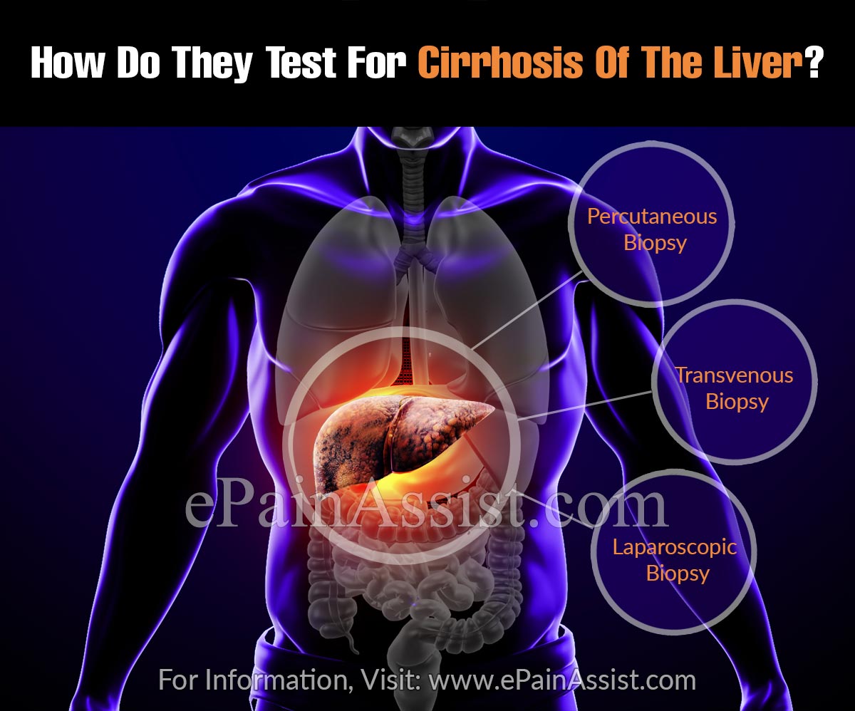 How Do They Test For Cirrhosis Of The Liver?