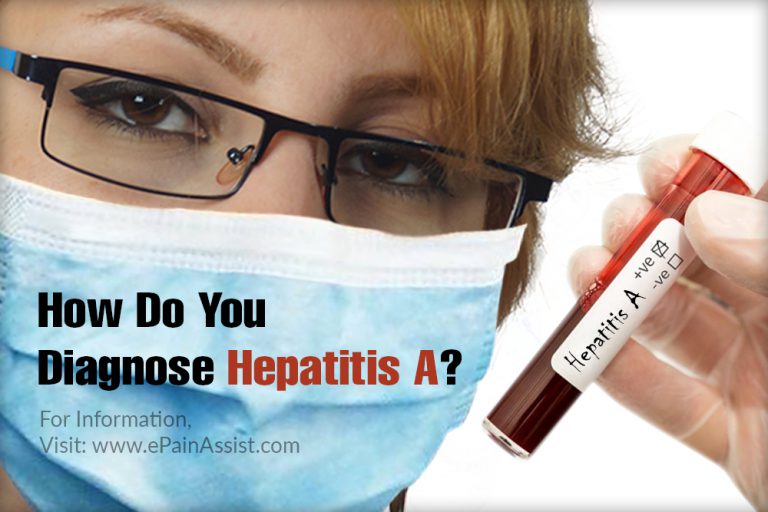 How Do You Diagnose Hepatitis A?