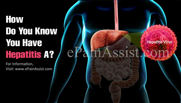 How Do You Know You Have Hepatitis A?