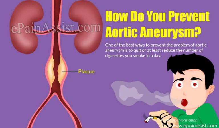 How Do You Prevent Aortic Aneurysm?