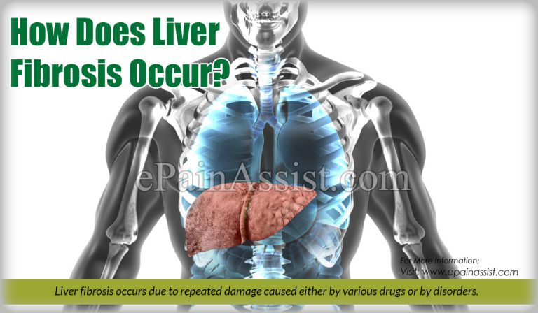 How Does Liver Fibrosis Occur?
