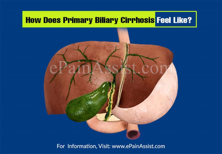 How Does Primary Biliary Cirrhosis Feel Like?