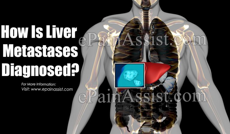 How Is Liver Metastases Diagnosed?