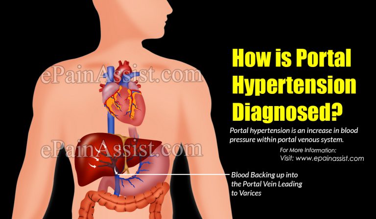 How is Portal Hypertension Diagnosed?