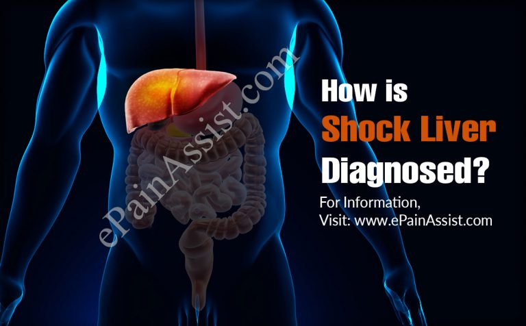 How is Shock Liver Diagnosed?