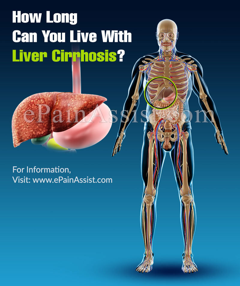 How Long Can You Live With Liver Cirrhosis?