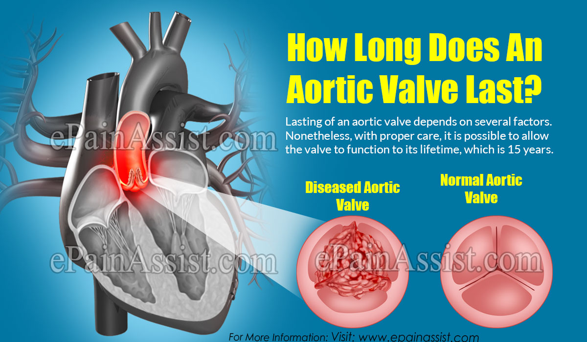 How Long Does An Aortic Valve Last?