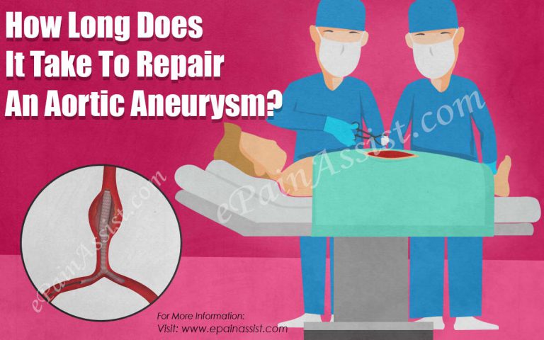 How Long Does It Take To Repair An Aortic Aneurysm?