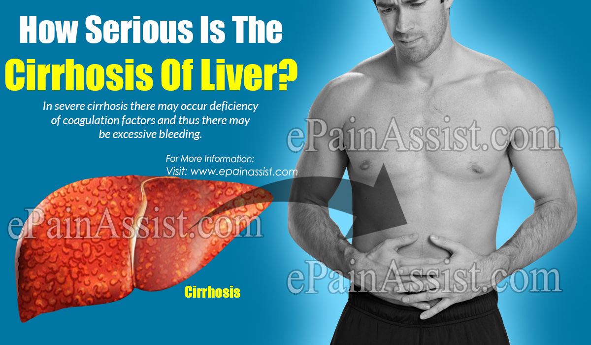 How Serious Is The Cirrhosis Of Liver?