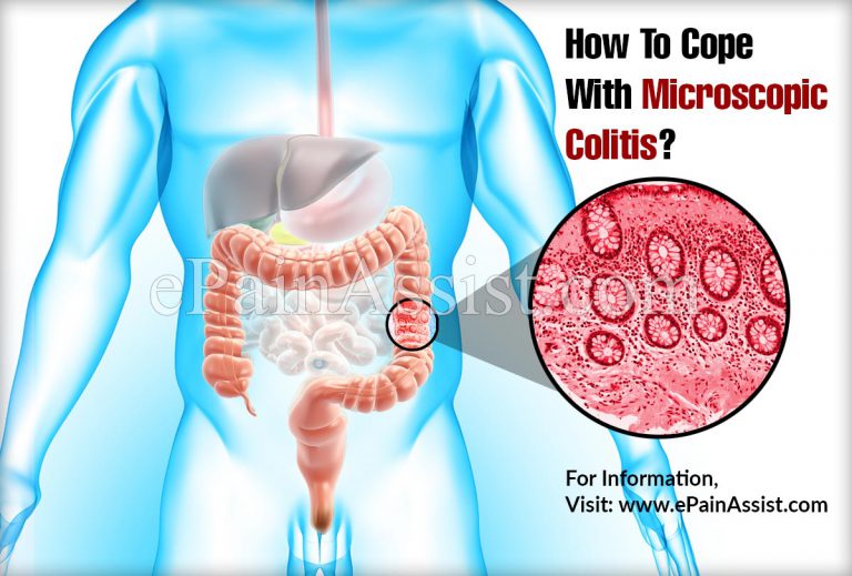 How To Cope With Microscopic Colitis?