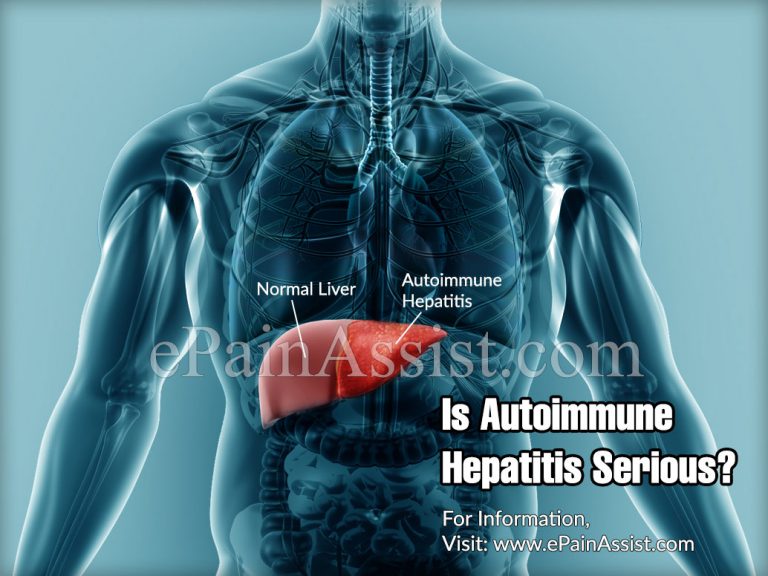 Is Autoimmune Hepatitis Serious?