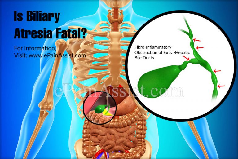Is Biliary Atresia Fatal?