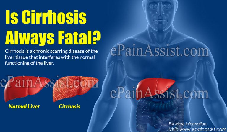 Is Cirrhosis Always Fatal?