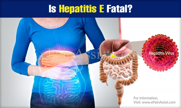 Is Hepatitis E Fatal?