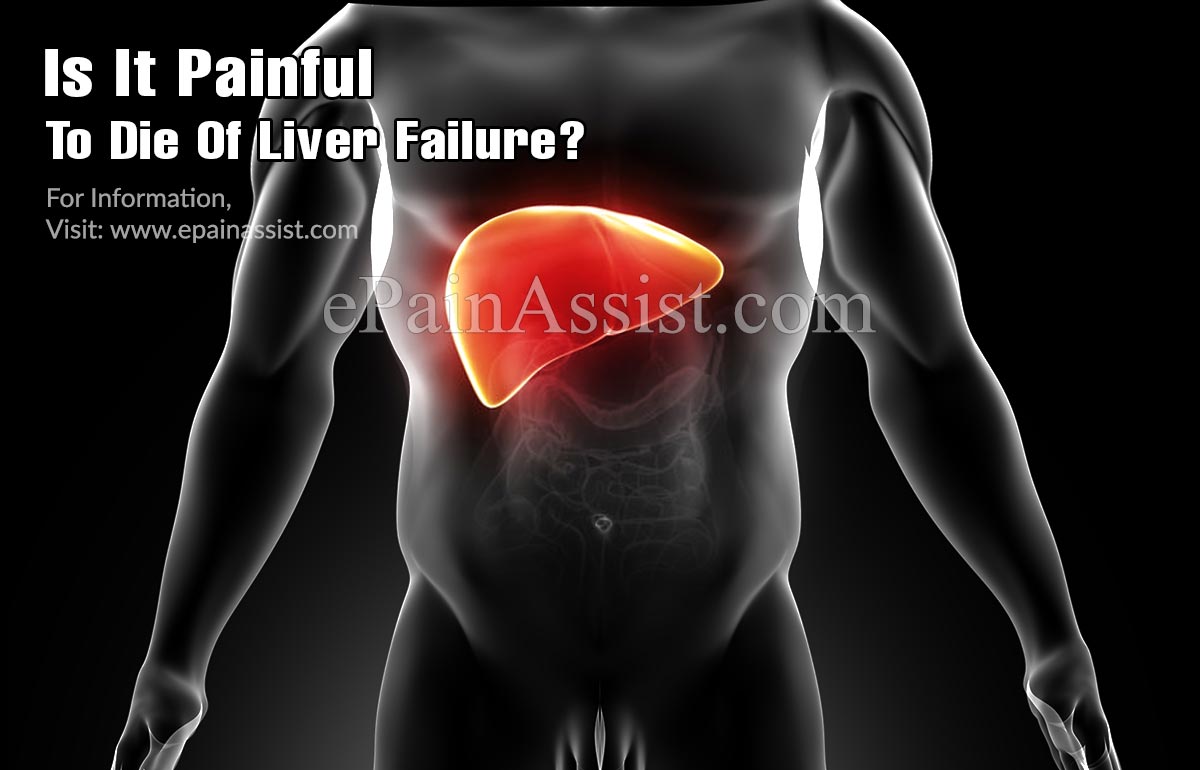 Is It Painful To Die Of Liver Failure?