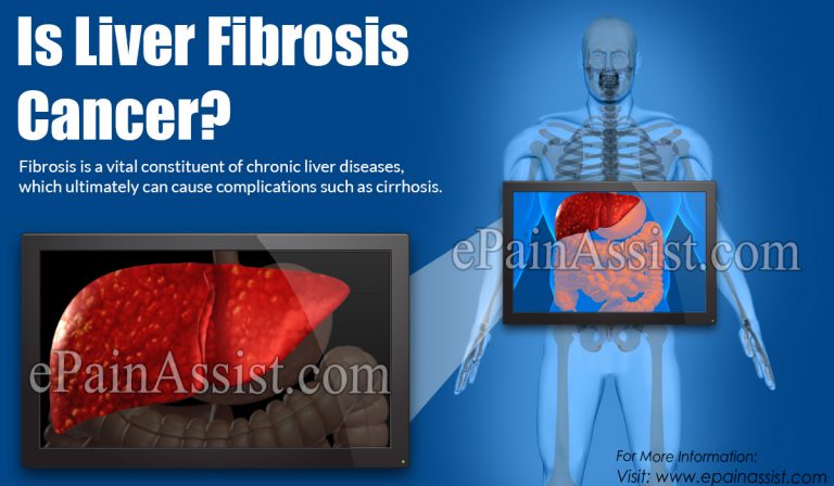 Is Liver Fibrosis Cancer?