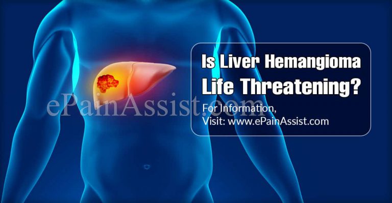 Is Liver Hemangioma Life Threatening?