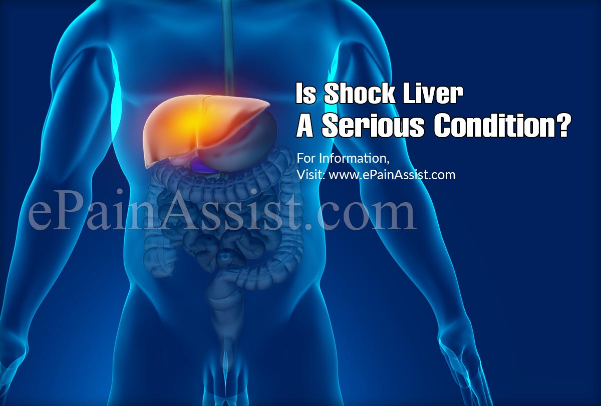 Is Shock Liver A Serious Condition?