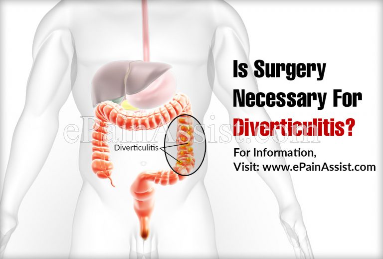 Is Surgery Necessary For Diverticulitis?